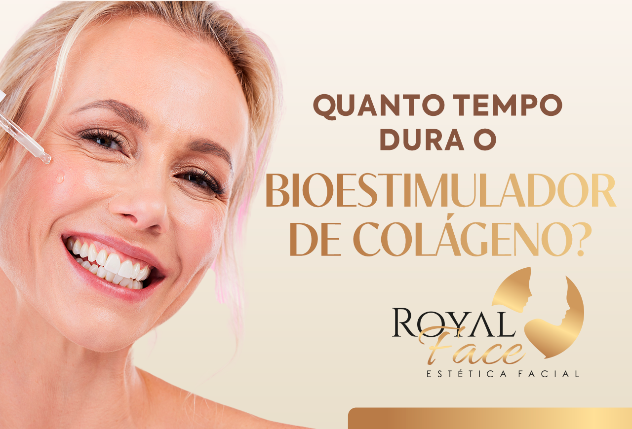 Quanto tempo dura o Bioestimulador de colágeno Royal Face