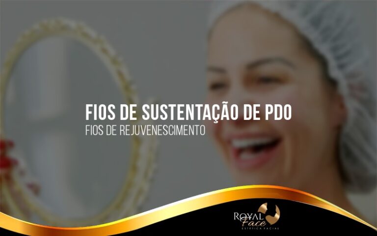 Fios de Sustentação: o que são, tipos e quanto tempo duram?