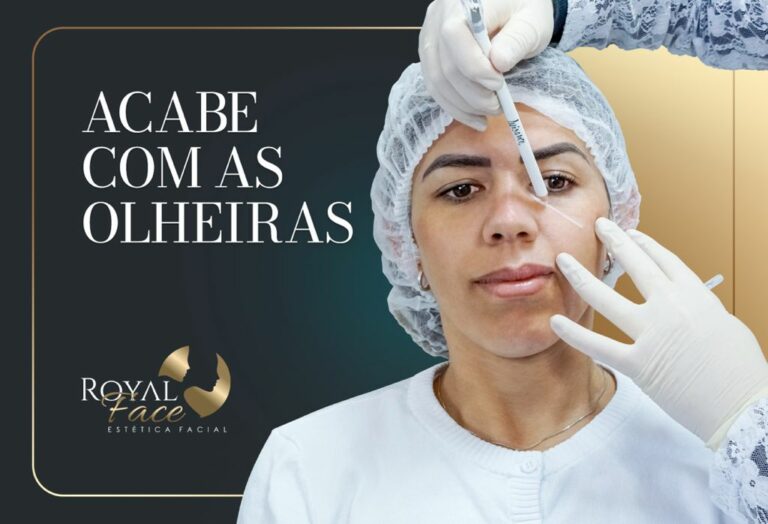 Olheiras: saiba as causas e como tratar os diferentes tipos
