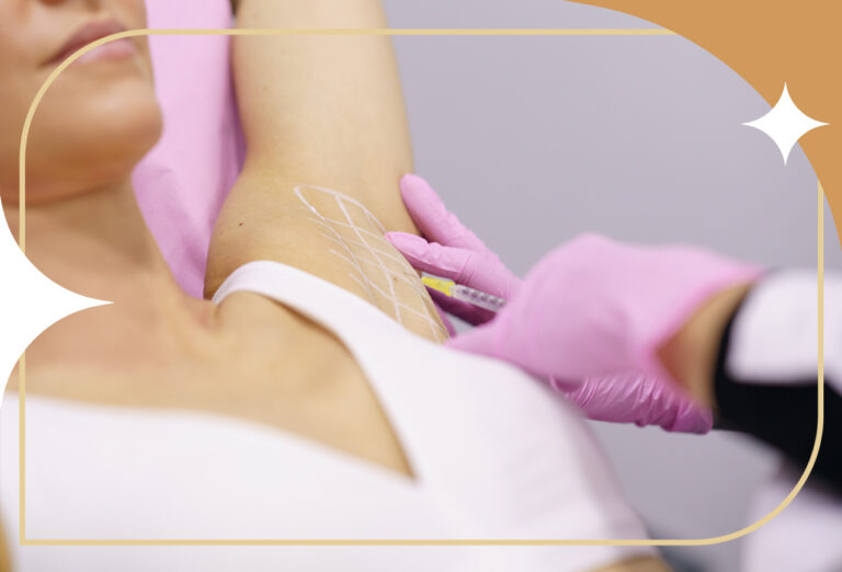 Botox para hiperidrose: opção para acabar com o suor excessivo