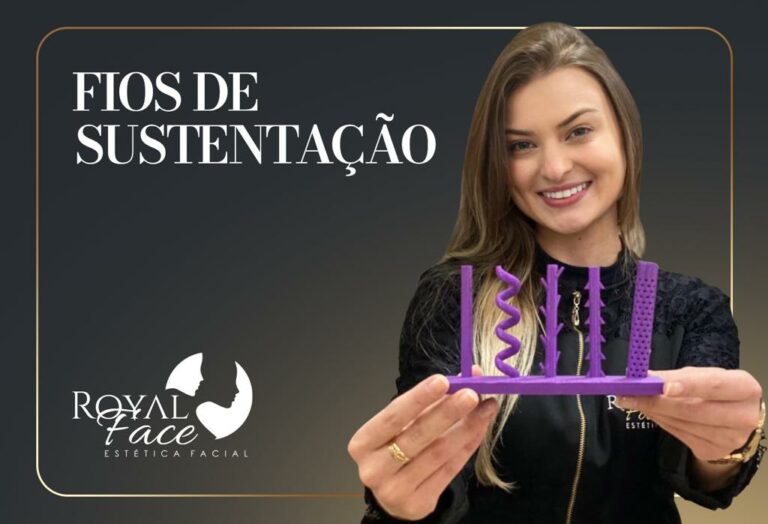 Tipos de Fios de Sustentação