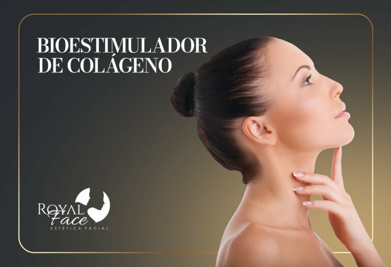 Tratamento para flacidez: bioestimulador de colágeno