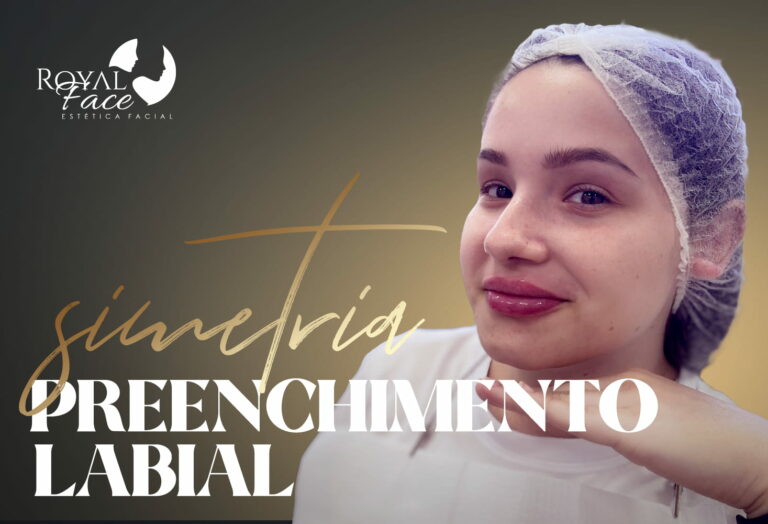 Melhore a simetria facial com preenchimento labial