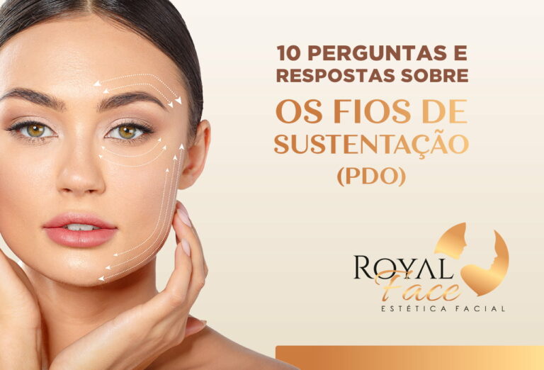 10 perguntas e respostas sobre os fios de sustentação – PDO