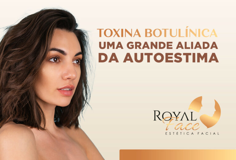 Toxina botulínica: uma grande aliada da autoestima