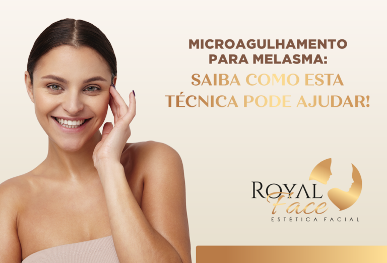 Melasma: saiba como o microagulhamento pode ajudar