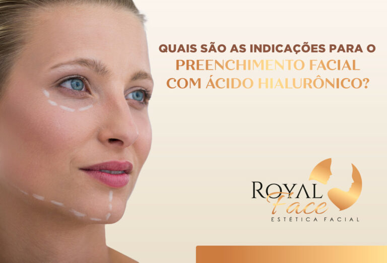 Indicações para o preenchimento facial: Conheça agora mesmo!