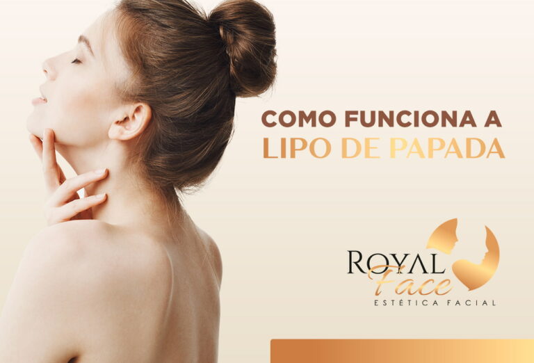Como funciona a lipo de papada