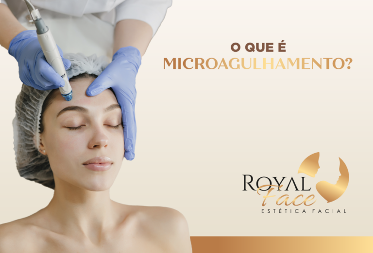 O que é microagulhamento?