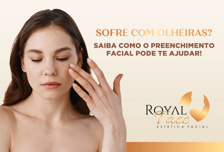 Sofre com olheiras? Saiba como o preenchimento facial pode te ajudar!