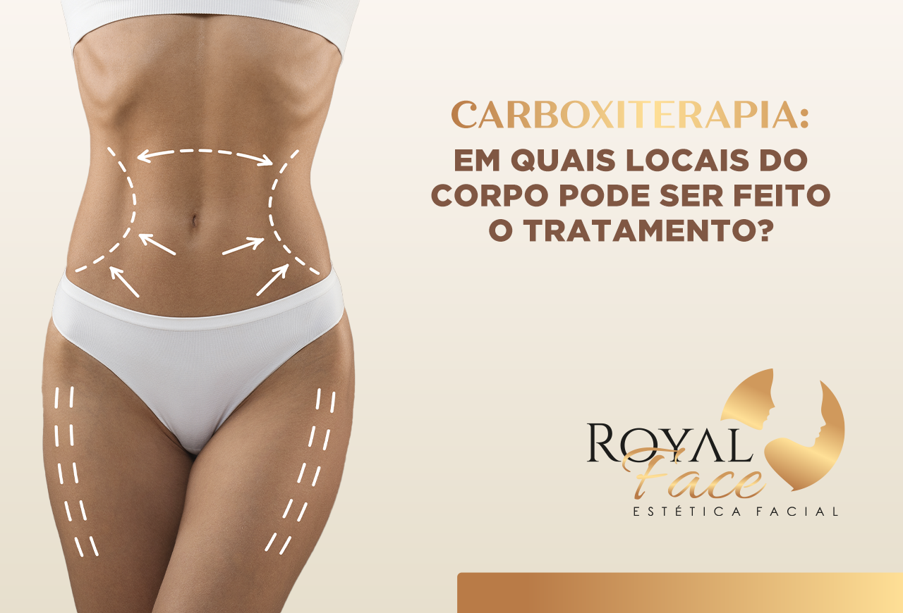 Em quais locais do corpo a carboxiterapia pode ser feita?