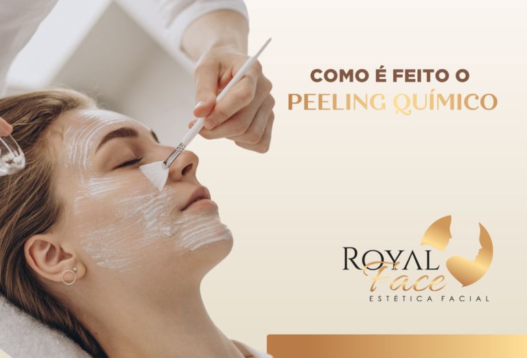 Como é feito o peeling químico