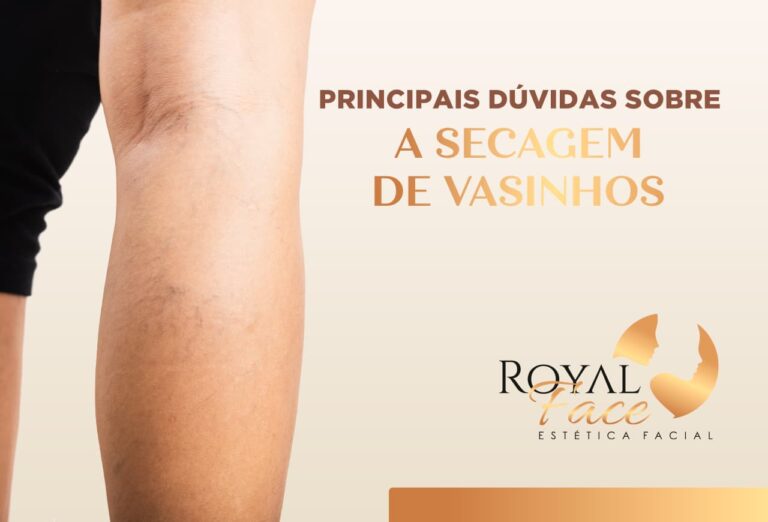 Principais dúvidas sobre a secagem de vasinhos