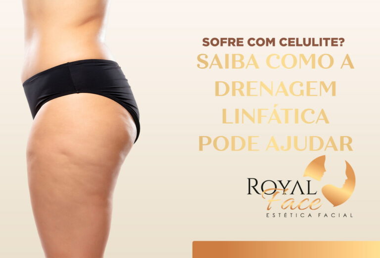 Tratamento para celulite? Saiba como a drenagem linfática pode te ajudar!