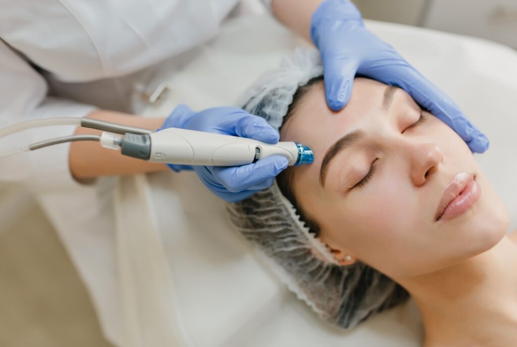 Como funciona o peeling de diamante?