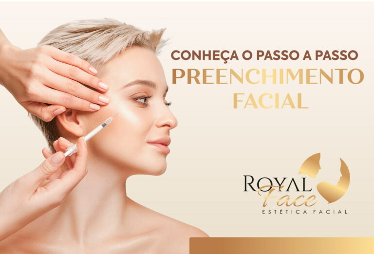 O passo a passo do preenchimento Facial: Realce a sua beleza