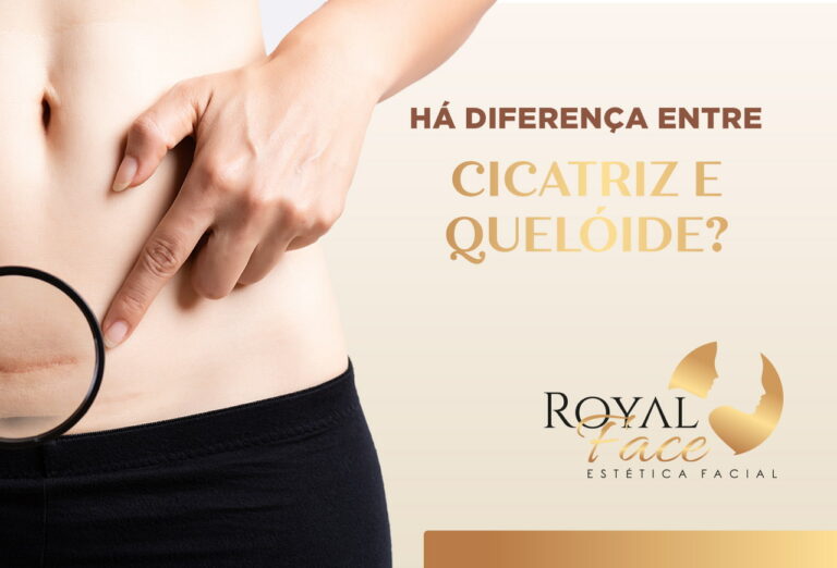 Há diferença entre cicatriz e queloide?