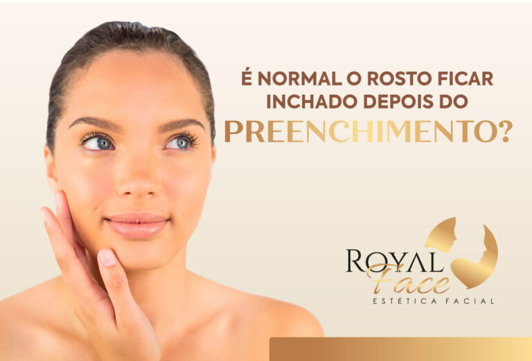Rosto inchado após o Preenchimento Facial: é normal?