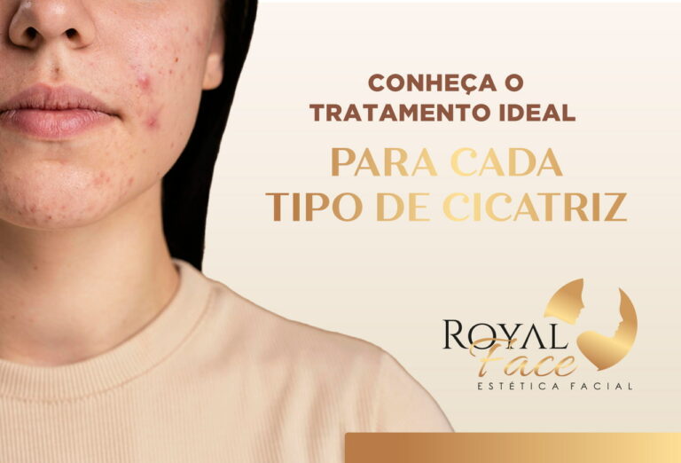 Conheça o tratamento ideal para cada tipo de cicatriz