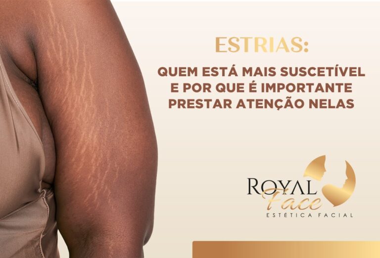 Estrias: Quem está mais suscetível e por que é importante prestar atenção nelas