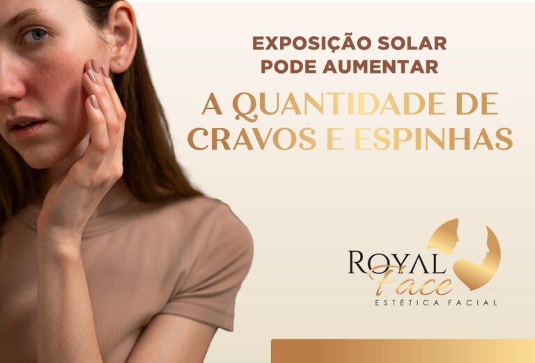 Exposição solar pode aumentar a quantidade de cravos e espinhas