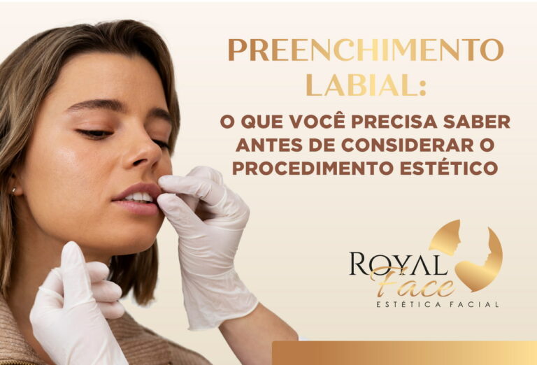 O que você precisa saber antes fazer o preenchimento labial