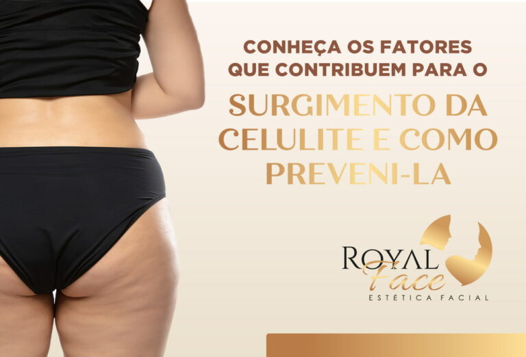 Conheça os fatores que contribuem para o surgimento da celulite e como preveni-la