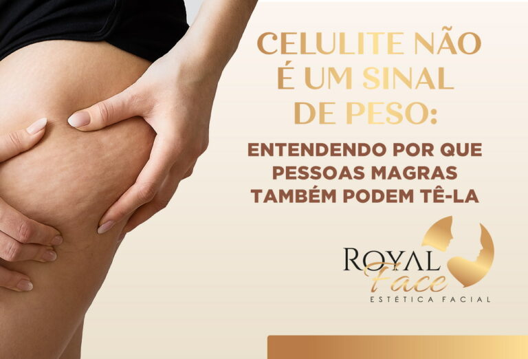 A celulite não é um sinal de sobrepeso: Pessoas magras também podem tê-la