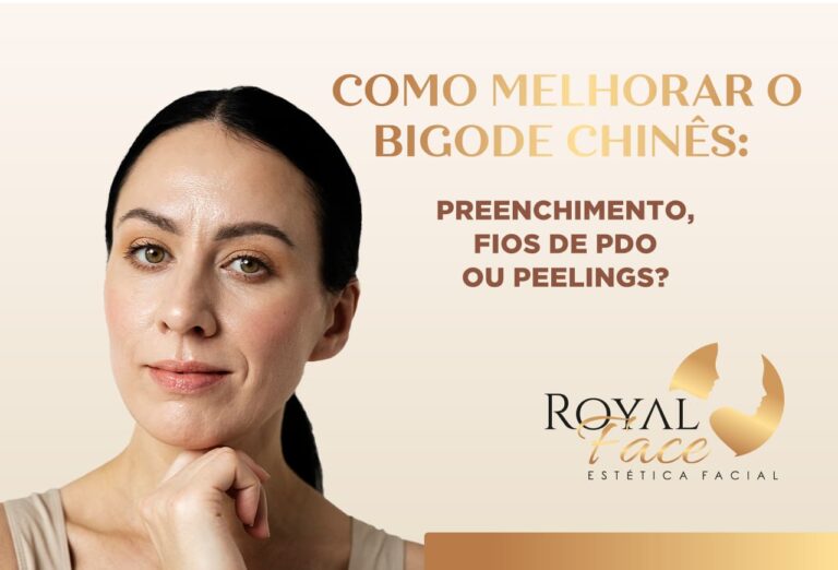 Como melhorar o bigode chinês: Preenchimento, Fios de PDO ou peelings?