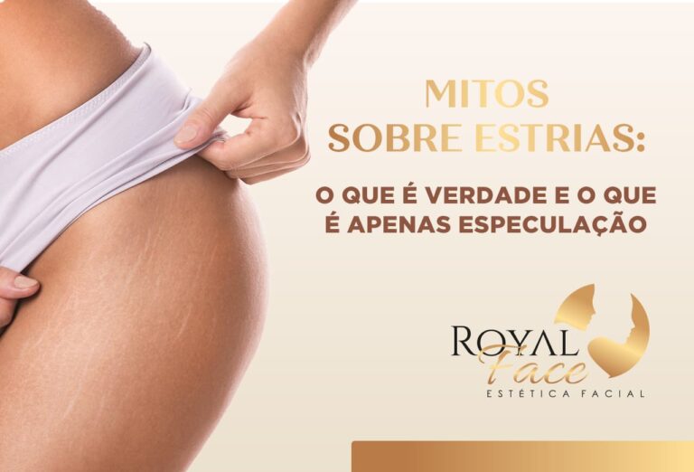Mitos sobre estrias: O que é verdade e o que é apenas especulação