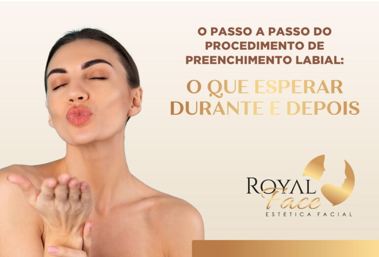 O passo a passo do preenchimento labial: O que esperar durante e depois