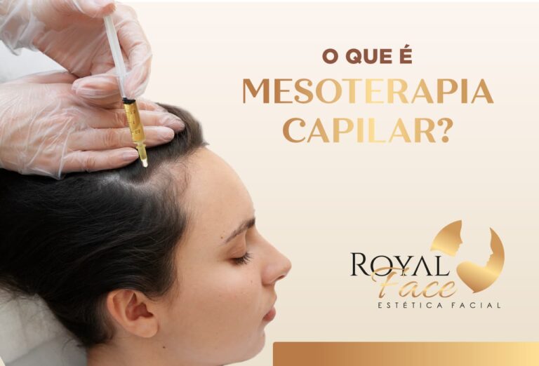 O que é a mesoterapia capilar?