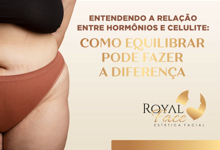Entendendo a relação entre hormônios e a celulite