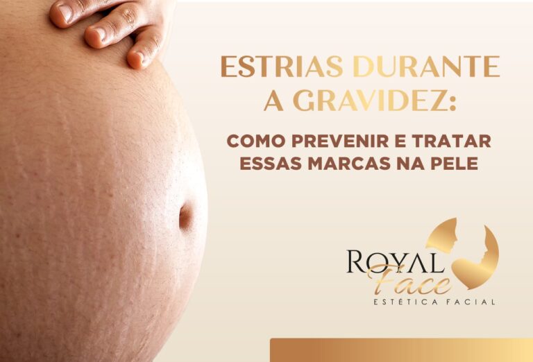 Estrias na gravidez: Como prevenir e tratar essas marcas na pele