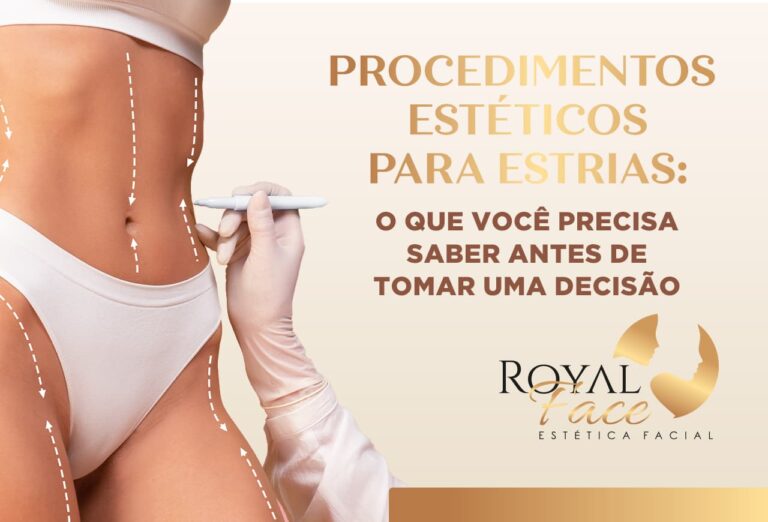 Procedimentos estéticos para estrias: O que você precisa saber antes de tomar uma decisão