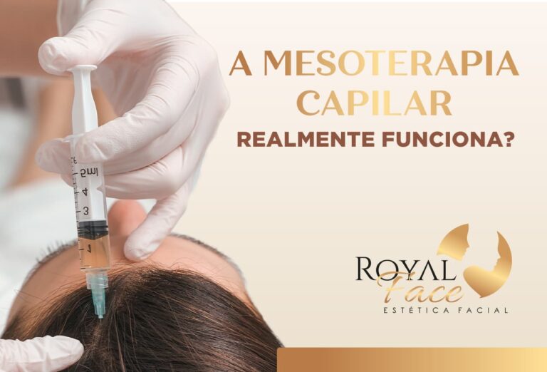 Cabelos fortes: A mesoterapia capilar realmente funciona?
