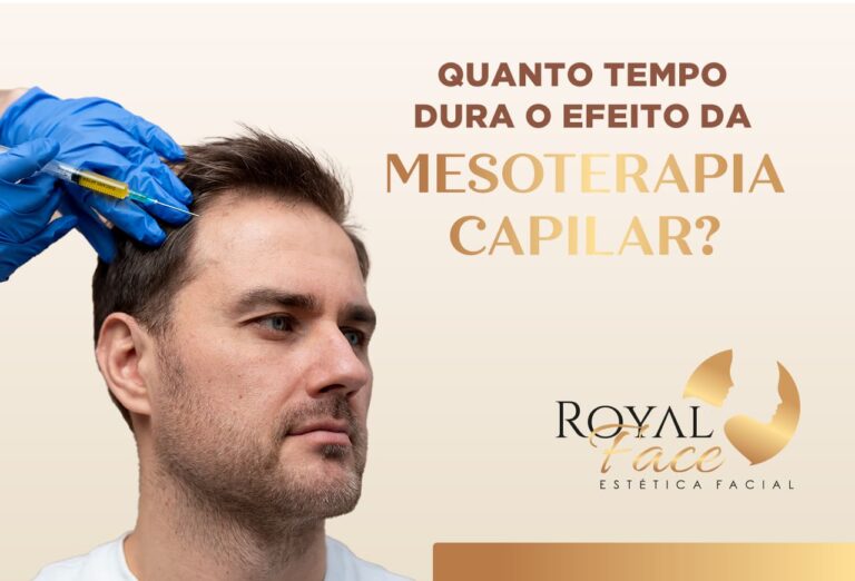 Quanto tempo dura o efeito da mesoterapia capilar?