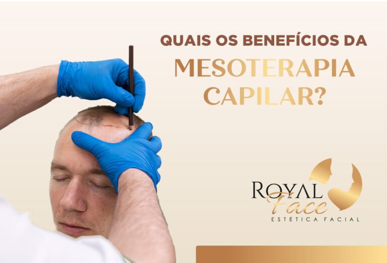 Quais os benefícios da mesoterapia capilar?