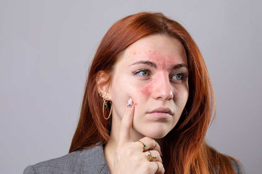 Contraindicação da limpeza de pele: Pele sensível
