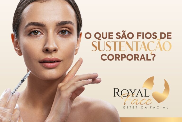 O que são fios de sustentação corporal