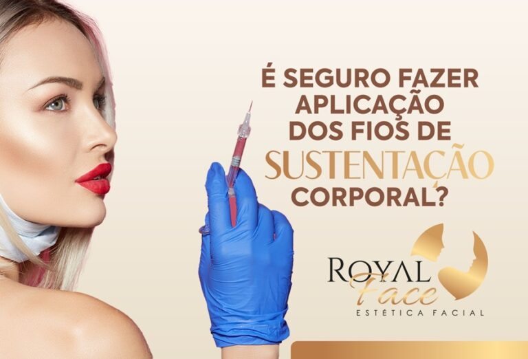 É seguro fazer a aplicação dos fios de sustentação corporal?