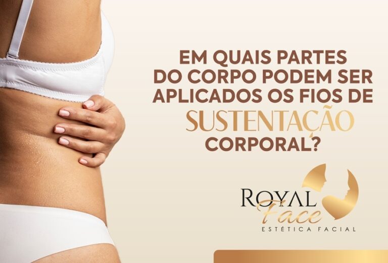 Em quais partes do corpo podem ser aplicados os fios de sustentação corporal?      