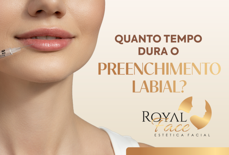 Quanto tempo dura o preenchimento labial?
