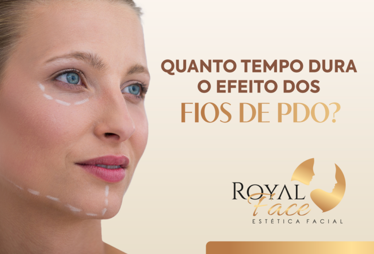 Quanto tempo dura o efeito dos fios de PDO?
