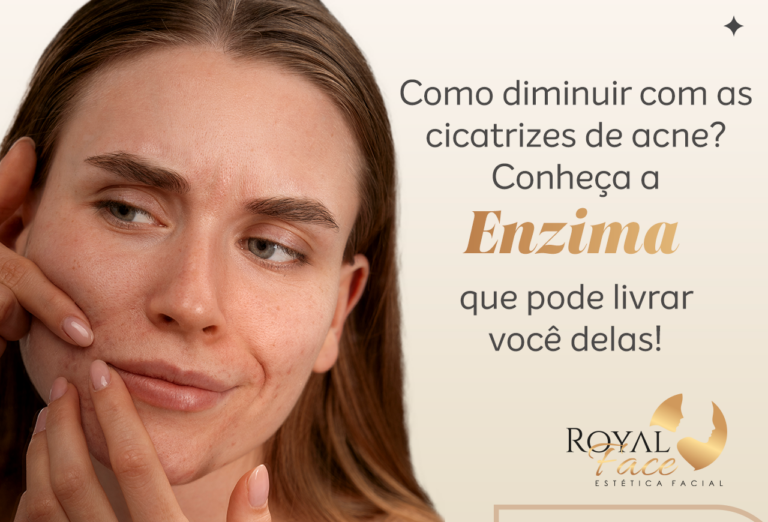 Como acabar com as cicatrizes de acne? Conheça a enzima que pode livrar você delas!