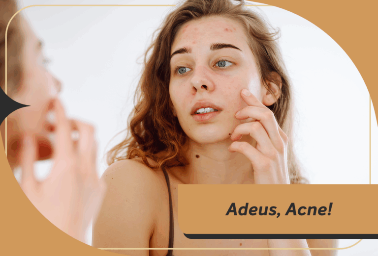 Como a Royal Face Te Ajuda A Dizer: Adeus, Acne!