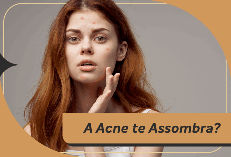 A Acne te Assombra? Descubra o Poder do Peeling de Diamante
