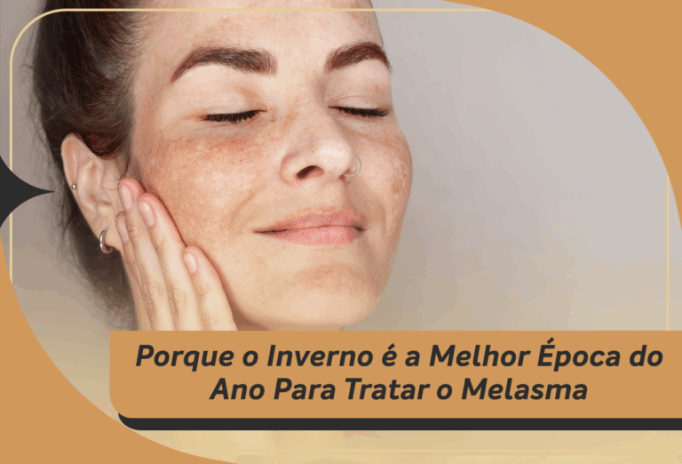 Porque o inverno é a melhor época do ano para tratar o Melasma