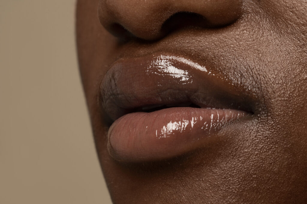 5 Benefícios secretos do Microagulhamento Labial! (1)