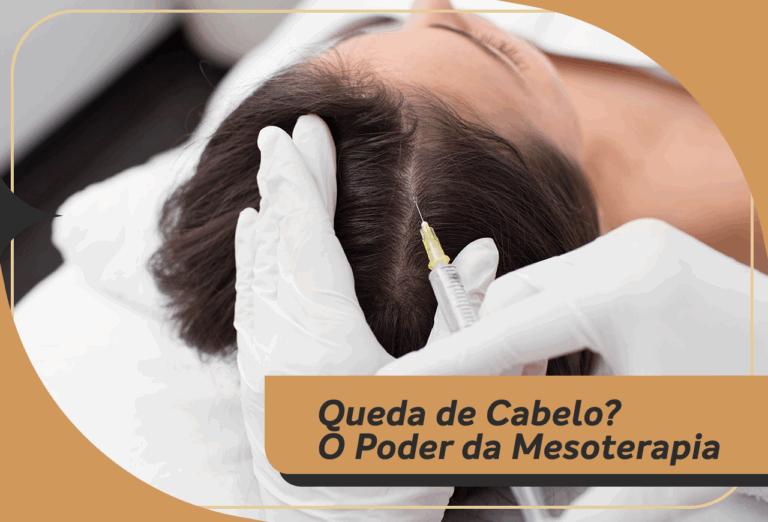 Queda de Cabelo? Conheça o Poder da Mesoterapia para tratar a Calvície